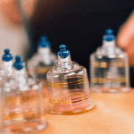 Best Cupping (Hijama) Therapy Centers in Riyadh