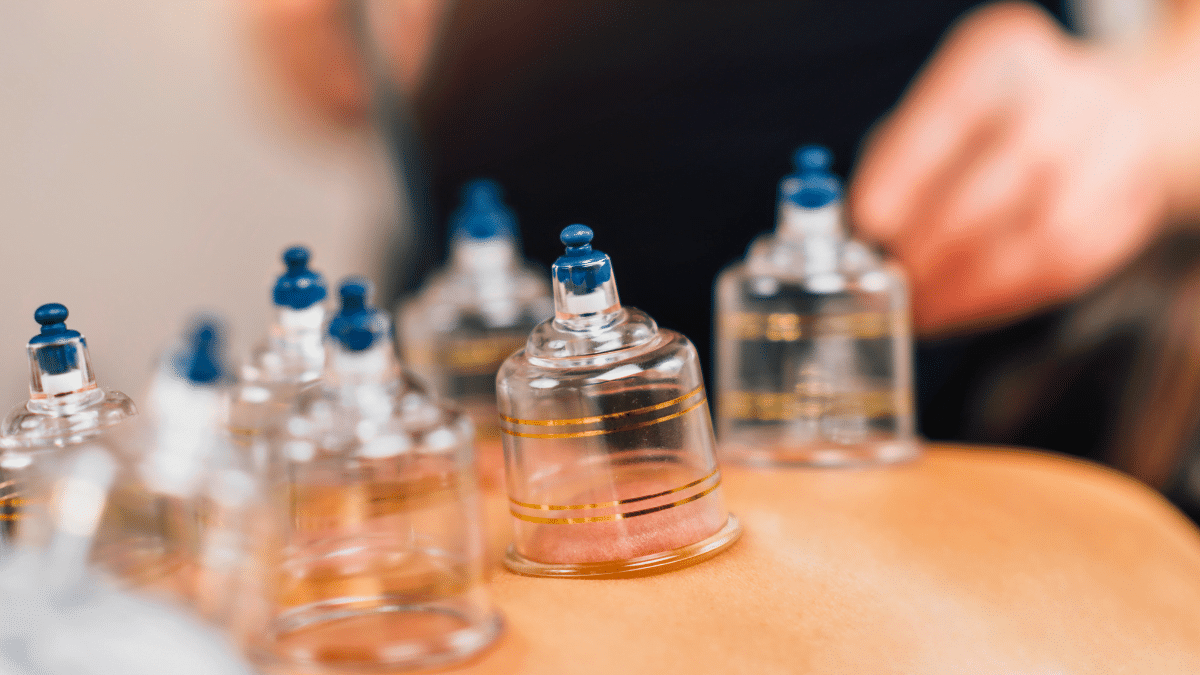 Best Cupping (Hijama) Therapy Centres in Riyadh