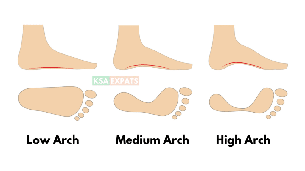 foot arch types, low arch, medium arch, high arch